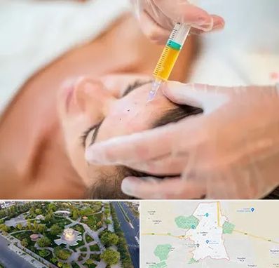 پی آر پی در کاشمر