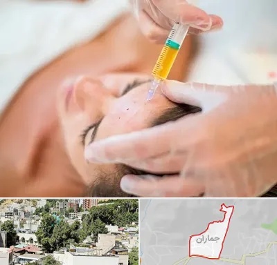 پی آر پی در جماران