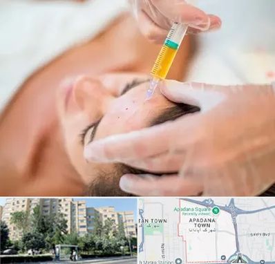 پی آر پی در آپادانا