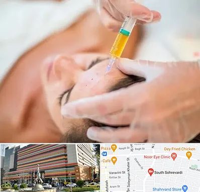 پی آر پی در سهروردی 