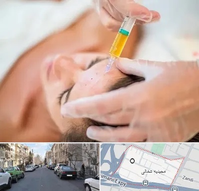 پی آر پی در مجیدیه شمالی