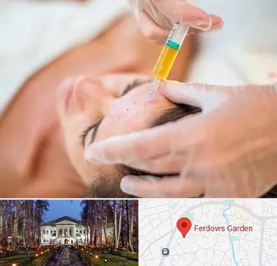 پی آر پی در باغ فردوس