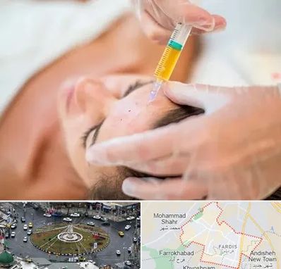 پی آر پی در فردیس کرج 