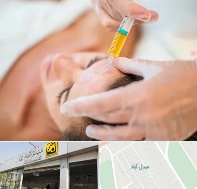 پی آر پی در عبدل آباد