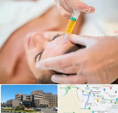 پی آر پی در صیاد شیرازی مشهد