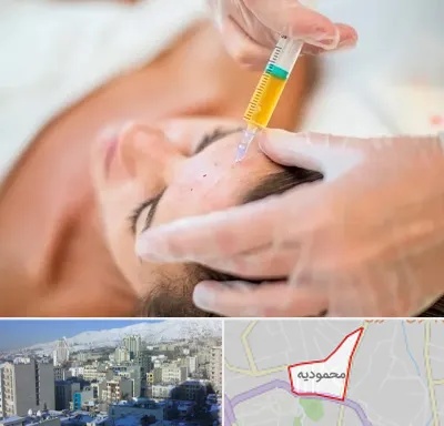 پی آر پی در محمودیه