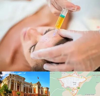 پی آر پی در خوی