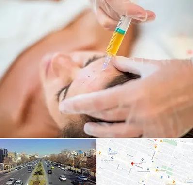 پی آر پی در بلوار معلم مشهد