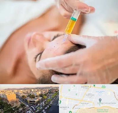 پی آر پی در تهرانپارس 