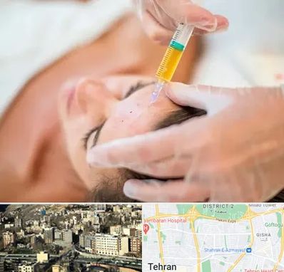 پی آر پی در مرزداران 