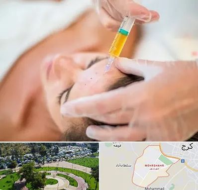 پی آر پی در مهرشهر کرج 