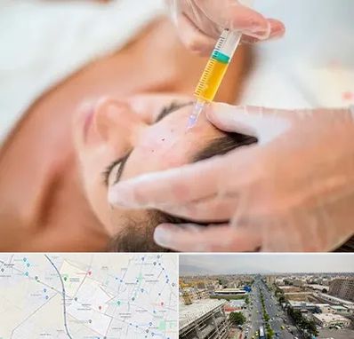 پی آر پی در حصارک کرج