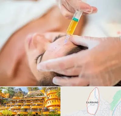 پی آر پی در دربند