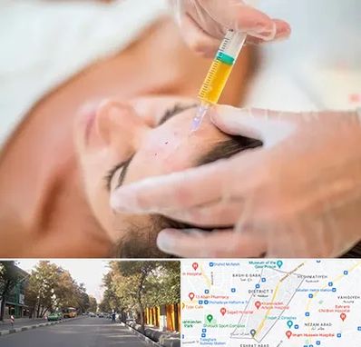 پی آر پی در شریعتی 