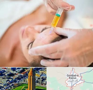 پی آر پی در گنبد کاووس