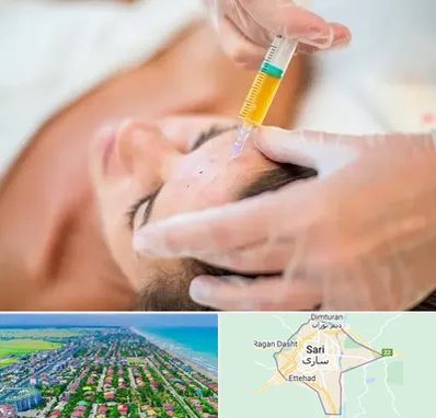 پی آر پی در ساری