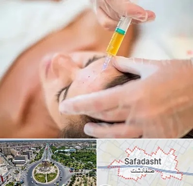پی آر پی در صفادشت