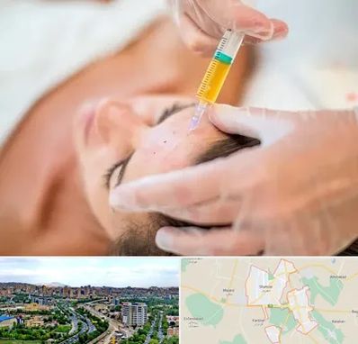 پی آر پی در شهریار