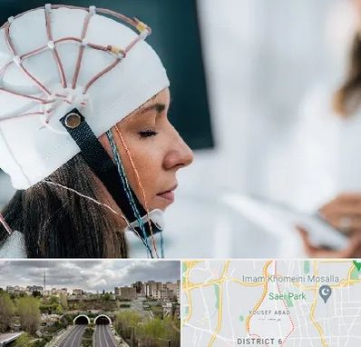 آزمایشگاه نقشه برداری مغز در یوسف آباد 