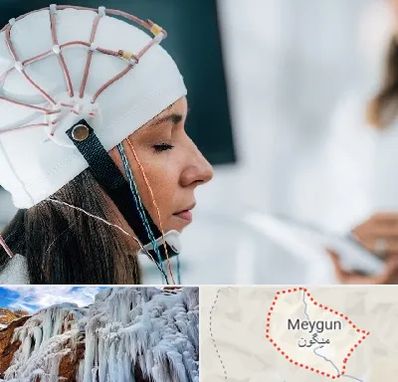 آزمایشگاه نقشه برداری مغز در میگون