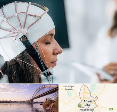 آزمایشگاه نقشه برداری مغز در اهواز