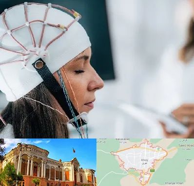 آزمایشگاه نقشه برداری مغز در خوی