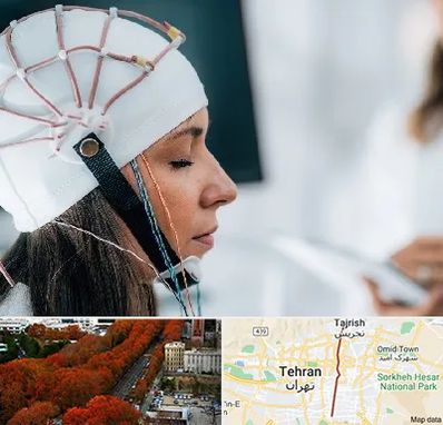 آزمایشگاه نقشه برداری مغز در ولیعصر 