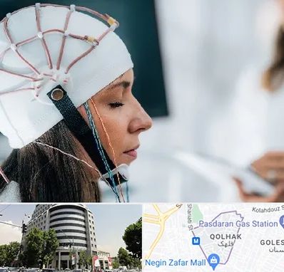 آزمایشگاه نقشه برداری مغز در قلهک 