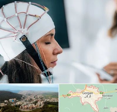 آزمایشگاه نقشه برداری مغز در گرگان