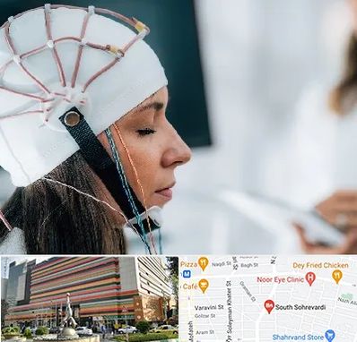 آزمایشگاه نقشه برداری مغز در سهروردی 