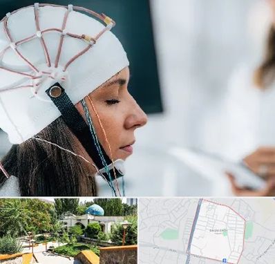 آزمایشگاه نقشه برداری مغز در باغمیشه تبریز