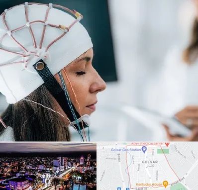 آزمایشگاه نقشه برداری مغز در گلسار رشت 