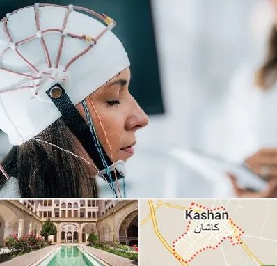 آزمایشگاه نقشه برداری مغز در کاشان