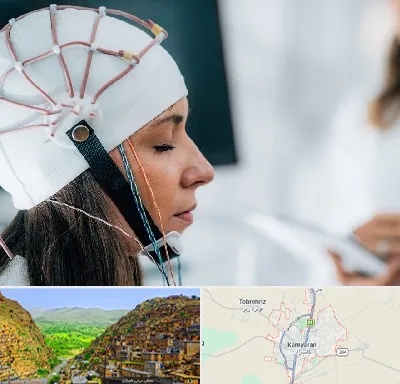 آزمایشگاه نقشه برداری مغز در کامیاران
