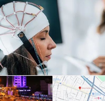 آزمایشگاه نقشه برداری مغز در آبرسان تبریز