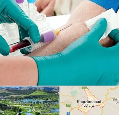آزمایشگاه در منزل در خرم آباد