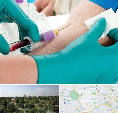 آزمایشگاه در منزل در منطقه 16 تهران 