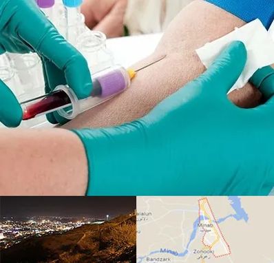 آزمایشگاه در منزل در میناب