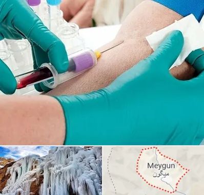 آزمایشگاه در منزل در میگون