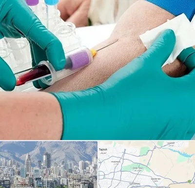 آزمایشگاه در منزل در شمال شرق تهران