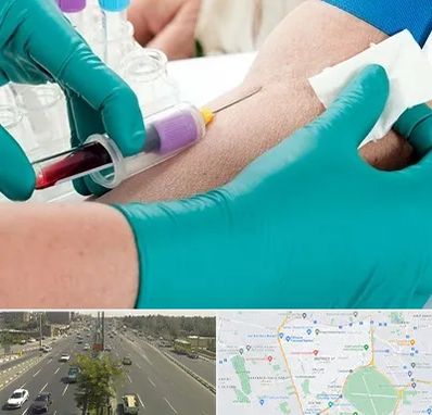 آزمایشگاه در منزل در منطقه 17 تهران 