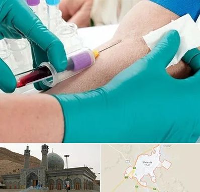 آزمایشگاه در منزل در شهرضا