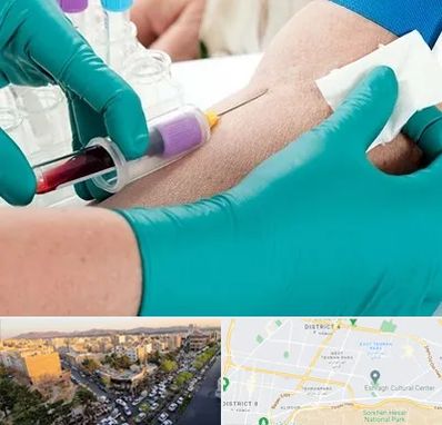 آزمایشگاه در منزل در تهرانپارس 