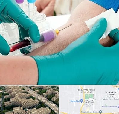 آزمایشگاه در منزل در اکباتان 