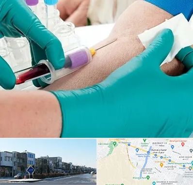 آزمایشگاه در منزل در شریعتی مشهد