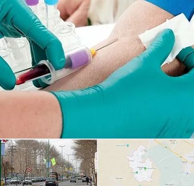 آزمایشگاه در منزل در نظرآباد کرج