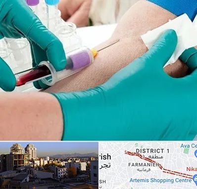 آزمایشگاه در منزل در فرمانیه 