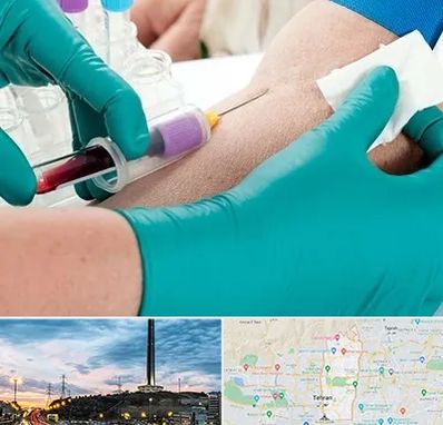 آزمایشگاه در منزل در منطقه 2 تهران 