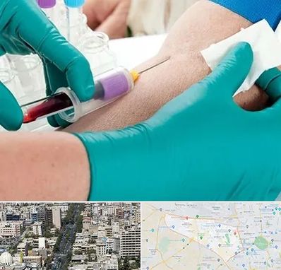 آزمایشگاه در منزل در منطقه 18 تهران 