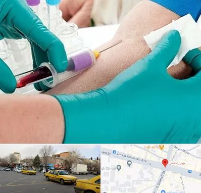 آزمایشگاه در منزل در شهناز تبریز